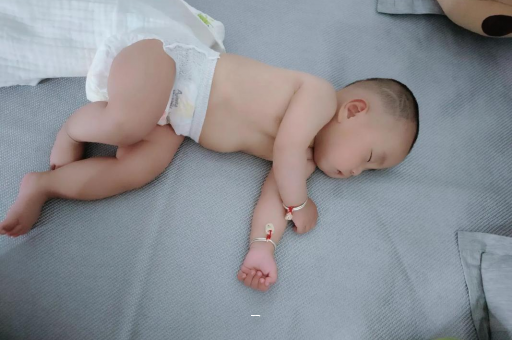 内江宝宝脸上有白色斑块